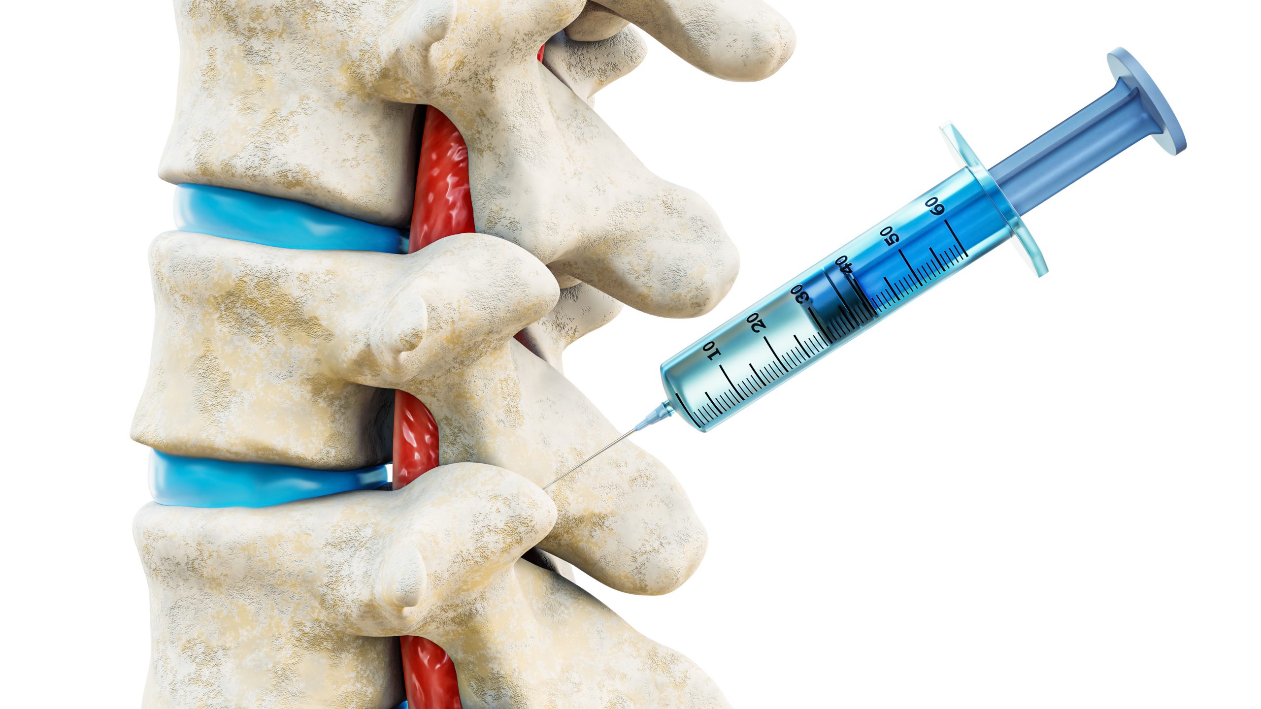 cervical facet joint nerve injection