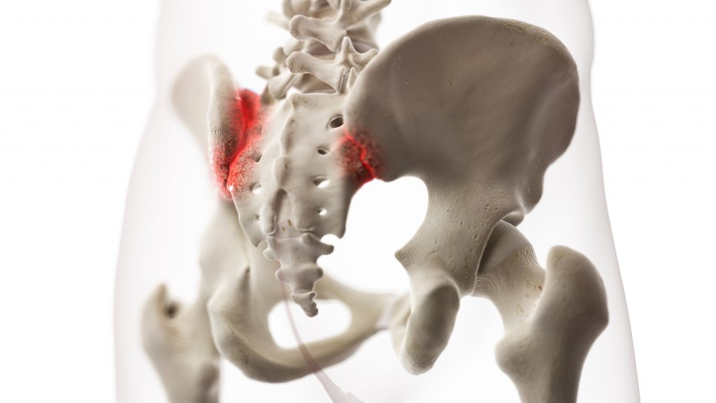 Sacroiliac (SI) Joint Pain - Total Spine and Orthopedics