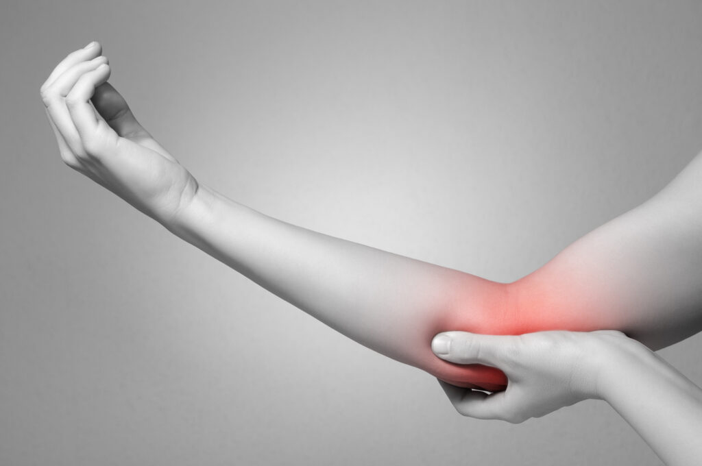 Cubital Tunnel Syndrome can cause painful symptoms in the hand and elbow