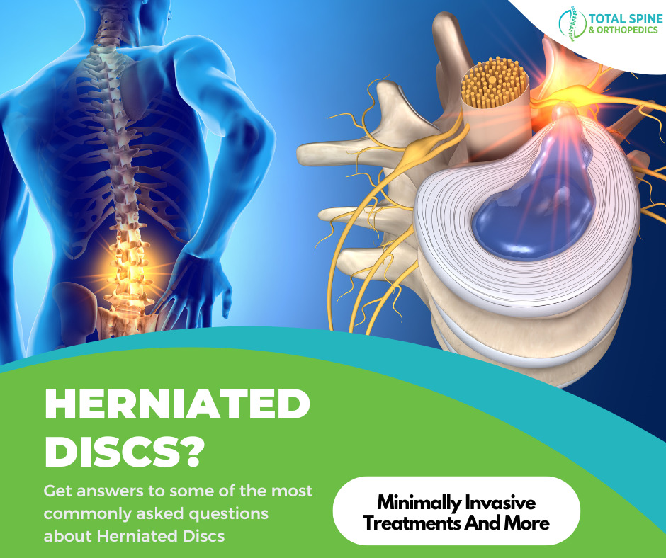 How to tell if you have a herniated disc - Causes, Symptoms, Treatment 