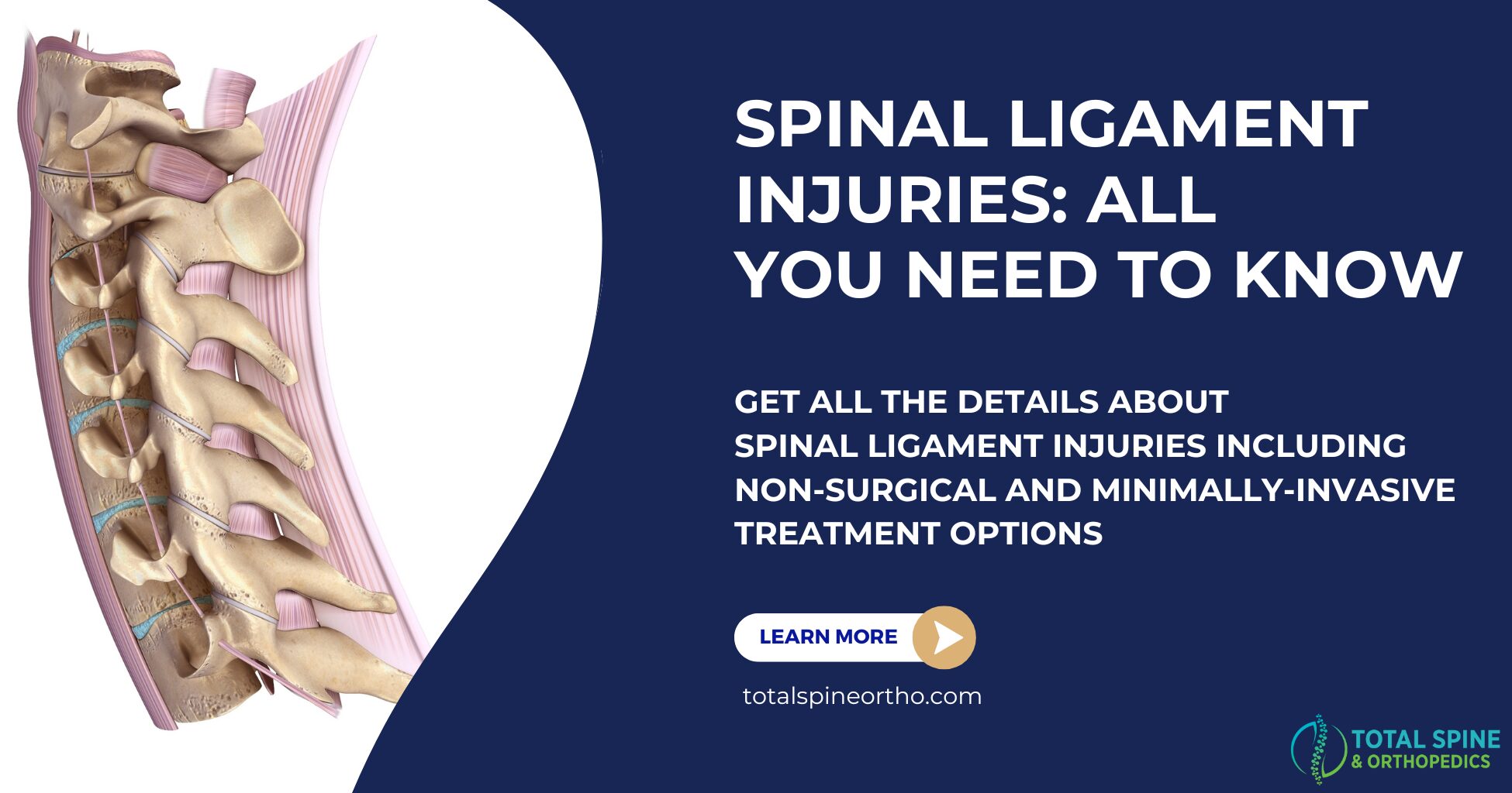 An information plaque about spinal ligament injuries.