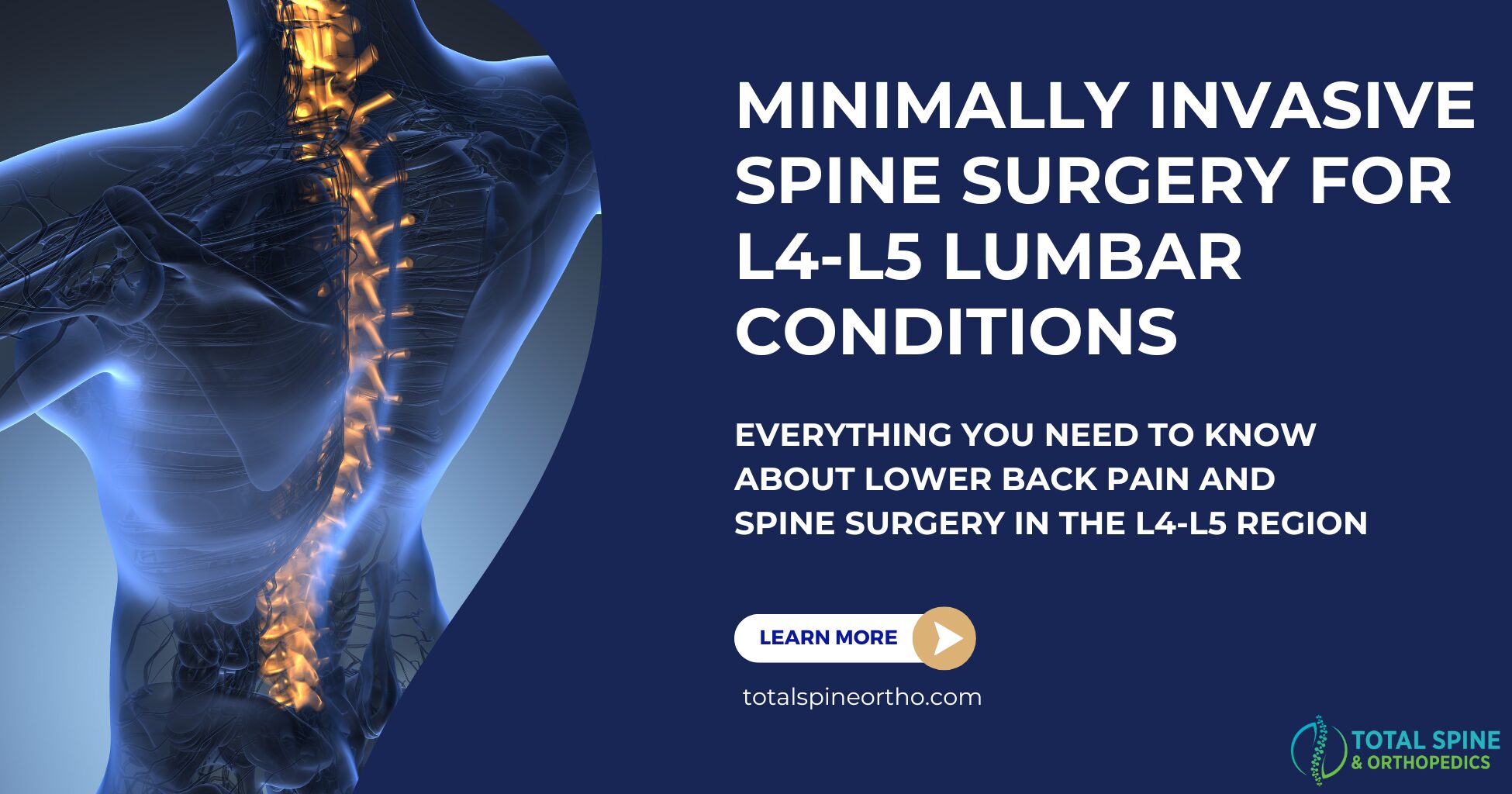 L4-L5 Treatments using Minimally Invasive spine Surgery