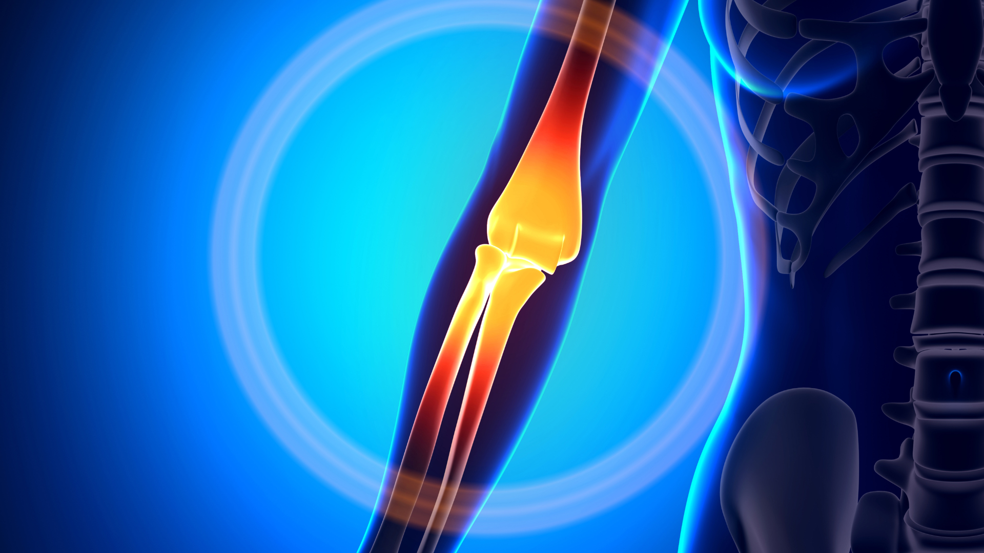 Total Spine and Orthopedics