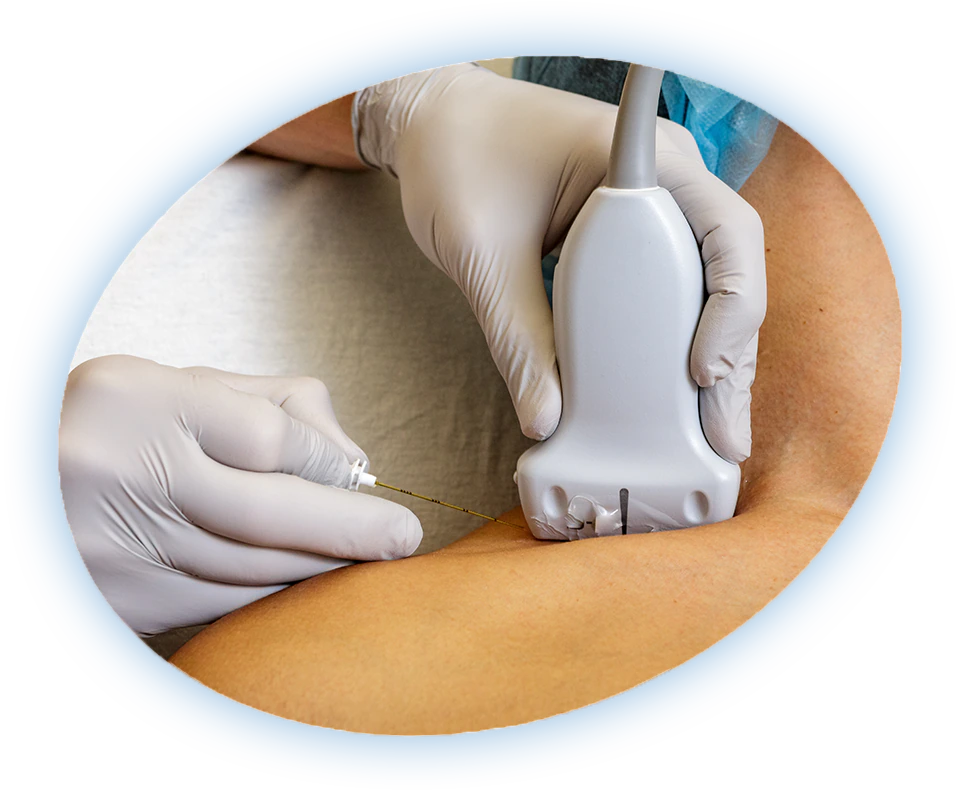 Ultrasound-guided nerve block injection