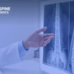 Doctor pointing to spine X-rays on a lightbox