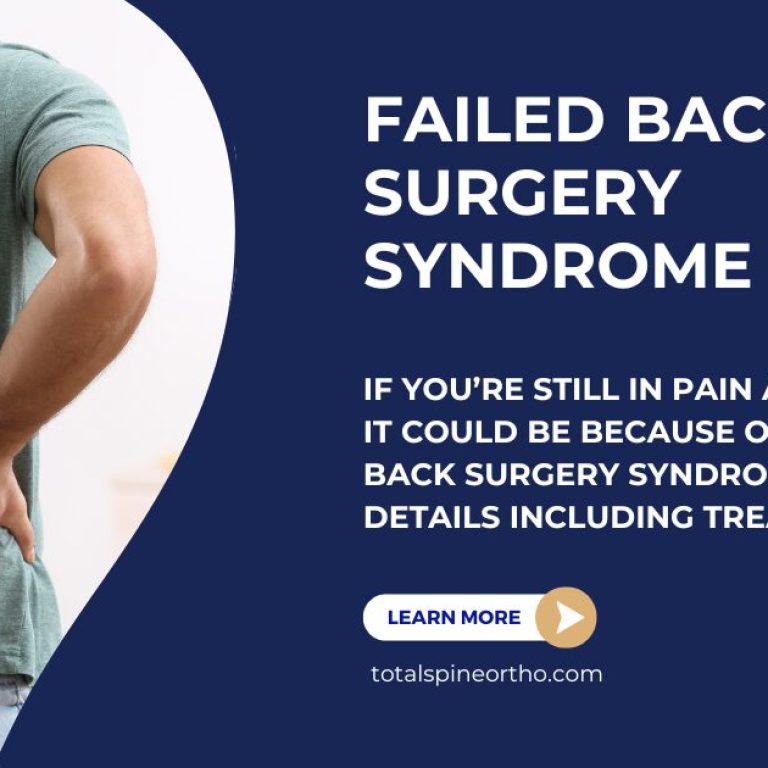 Failed Back Surgery Syndrome Information Card
